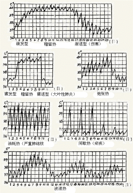 间歇热多见于-妇产科护理学题库-考无忧网校