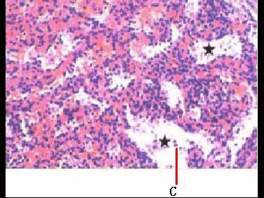 红髓c.脾窦d.动脉周围淋巴鞘e.脾小梁2[单选题]d箭头所指为a.白髓b.
