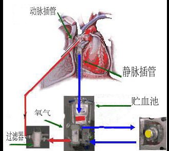 如图所示,体外循环的基本原理是